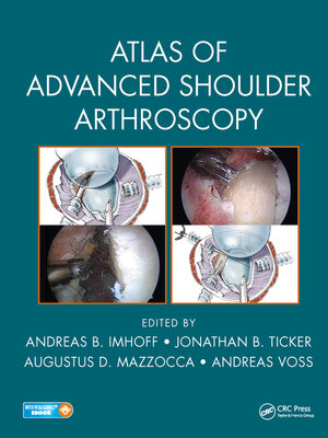 cover image of Atlas of Advanced Shoulder Arthroscopy